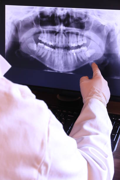 Best Emergency Wisdom Teeth Removal in Lamont, CA